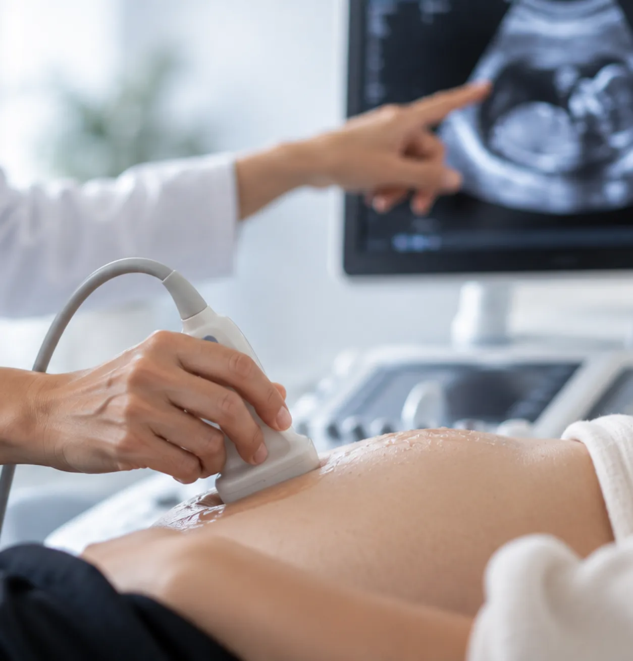 Profesional realizando una ecografía obstétrica a una paciente embarazada durante una consulta de Ginecología y Obstetricia.