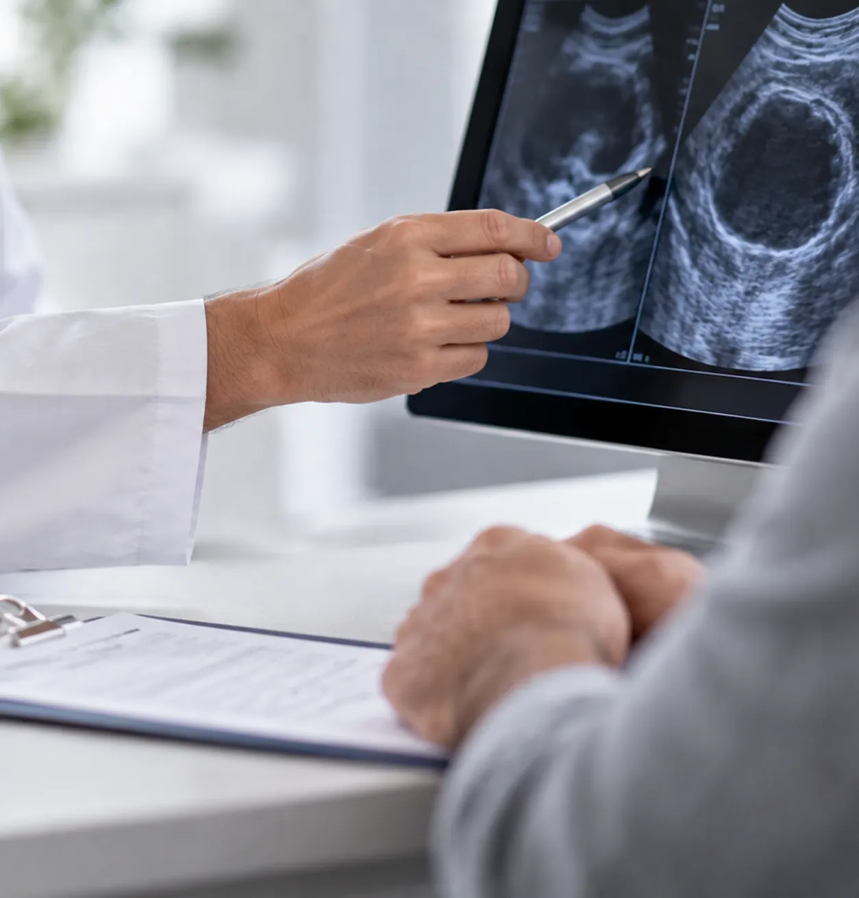 Urólogo explicando un estudio ecográfico durante una consulta médica.